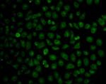 CD54 (ICAM-1) Antibody in Immunocytochemistry (ICC/IF)
