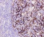 CD54 (ICAM-1) Antibody in Immunohistochemistry (Paraffin) (IHC (P))