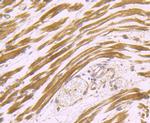 Dysferlin Polyclonal Antibody