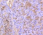 PHF10 Polyclonal Antibody
