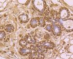 PINK1 Antibody in Immunohistochemistry (Paraffin) (IHC (P))