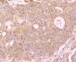 PINK1 Antibody in Immunohistochemistry (Paraffin) (IHC (P))