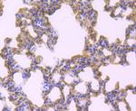 TNFAIP3 Antibody in Immunohistochemistry (Paraffin) (IHC (P))