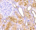 TNFAIP3 Antibody in Immunohistochemistry (Paraffin) (IHC (P))