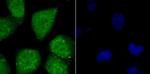 ATF6 Polyclonal Antibody