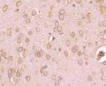 KV1.4 (KCNA4) Antibody in Immunohistochemistry (Paraffin) (IHC (P))