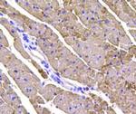 Cardiac Troponin T Polyclonal Antibody