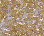 c-Met Antibody in Immunohistochemistry (Paraffin) (IHC (P))