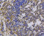 c-Met Antibody in Immunohistochemistry (Paraffin) (IHC (P))