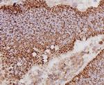c-Met Antibody in Immunohistochemistry (Paraffin) (IHC (P))