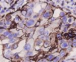 CD9 Antibody in Immunohistochemistry (Paraffin) (IHC (P))