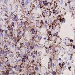CD9 Antibody in Immunohistochemistry (Paraffin) (IHC (P))