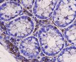 CD9 Antibody in Immunohistochemistry (Paraffin) (IHC (P))