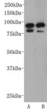 CD19 Antibody in Western Blot (WB)