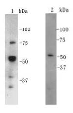 CD4 Antibody in Western Blot (WB)