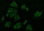 CaMKII delta Polyclonal Antibody