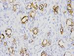 Cytokeratin 7 Antibody in Immunohistochemistry (Paraffin) (IHC (P))