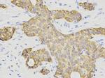 Cytokeratin 7 Antibody in Immunohistochemistry (Paraffin) (IHC (P))