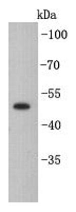 Cytokeratin 7 Antibody in Western Blot (WB)