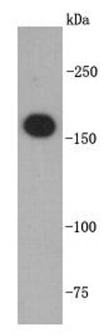 TOP2A Antibody in Western Blot (WB)