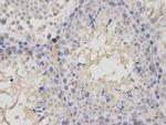 GMNN Antibody in Immunohistochemistry (Paraffin) (IHC (P))