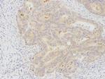 MKRN2 Polyclonal Antibody