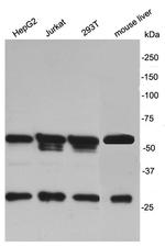 MKRN2 Antibody in Western Blot (WB)
