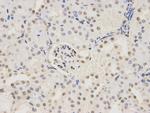RBM8A Antibody in Immunohistochemistry (Paraffin) (IHC (P))
