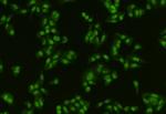 PTBP1 Polyclonal Antibody