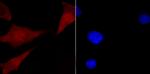 CUG-BP2 Polyclonal Antibody