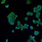 Cathepsin B Polyclonal Antibody