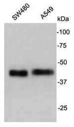 Cathepsin B Antibody in Western Blot (WB)