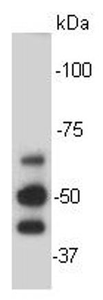 KLHL15 Antibody in Western Blot (WB)