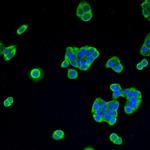 AKR7A2 Polyclonal Antibody