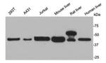 AKR7A2 Antibody in Western Blot (WB)