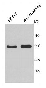 HADH Polyclonal Antibody