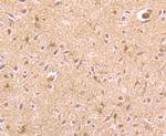 REM2 Antibody in Immunohistochemistry (Paraffin) (IHC (P))