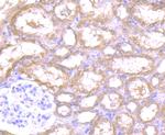 REM2 Antibody in Immunohistochemistry (Paraffin) (IHC (P))