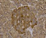 TMEM39A Antibody in Immunohistochemistry (Paraffin) (IHC (P))