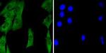 TET1 Polyclonal Antibody