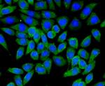 TSC2 Polyclonal Antibody