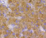 TSC2 Antibody in Immunohistochemistry (Paraffin) (IHC (P))