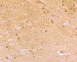 Nestin Antibody in Immunohistochemistry (Paraffin) (IHC (P))