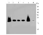 PRDX2 Antibody in Western Blot (WB)