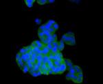 PHD2 Polyclonal Antibody