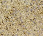 PHD2 Antibody in Immunohistochemistry (Paraffin) (IHC (P))