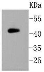 PHD2 Antibody in Western Blot (WB)