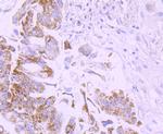 PD-L1 (CD274) Antibody in Immunohistochemistry (Paraffin) (IHC (P))
