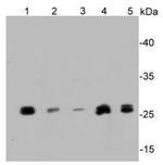 SIRT3 Polyclonal Antibody