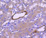 NOX4 Antibody in Immunohistochemistry (Paraffin) (IHC (P))